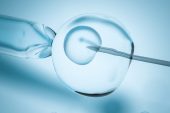 Yumurta Toplama İşlemi ve Embriyo Transferi (OPU)