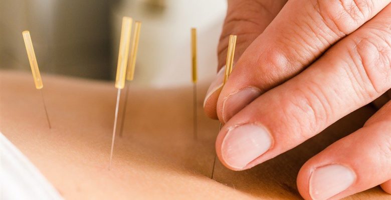 Akupunktur İle Nasıl Zayıflanır