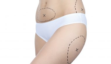Liposuction Yöntemindeki En Yeni Teknik Islak Liposuction